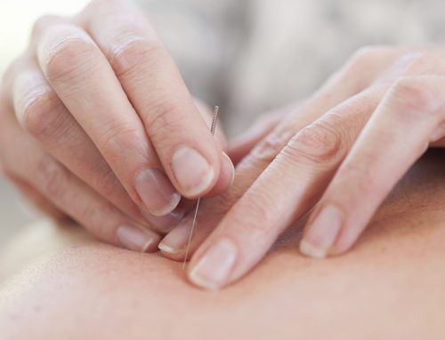 The Benefits of Dry Needling: A Modern Approach to Pain Relief